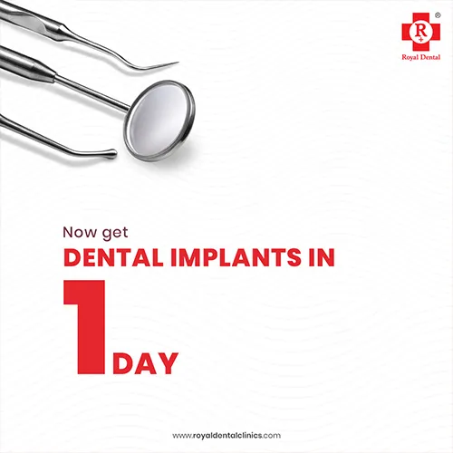Dental Implant In One Day Possible?