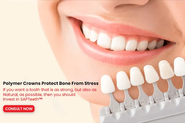Dental Crown in SAPTeeth™